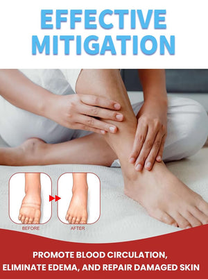 Leg Slimming Massage Cream | Soothing Swelling, Tightening Skin, Auxiliary Care for Reducing Edema (2 Pieces) bobojujuBuy Supplements Australia