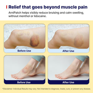 Arnica Hydrogel Pain Relief Patches | Natural Relief for Muscle, Joint, Bruises & Swelling | Flexible, Non-Greasy & Long-Lasting | Great for Back, Knee & Neck Pain (3.9"x4.7", 10, Count) Wooshin LabottachBuy Supplements Australia