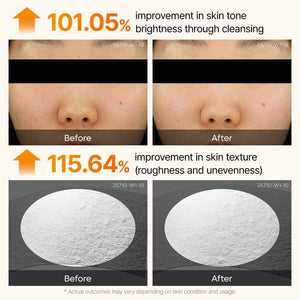 Dr. Melaxin Peel Shot Kojic Acid Turmeric Serum β Exfoliating Dark Spot Corrector with AHA/BHA & Niacinamide, Brightening & Even Tone